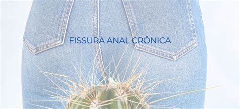 Fissura Anal Crônica Sintomas Causas e Procedimentos de Recuperação Dra Vitoria Marra