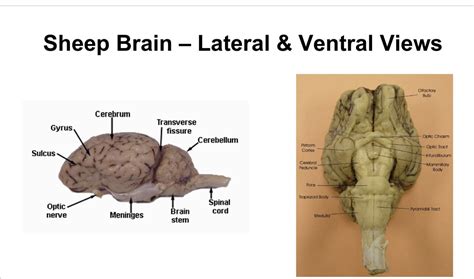 Sheep Brain Lateral View Diagram Quizlet