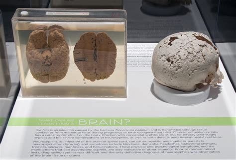 National Museum Of Health And Medicine Nmhm Never Before Seen Photos