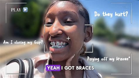 Braces Vlog Getting Braces For The First Time Youtube