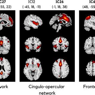 Spatial Maps Of ICs Comprising Selected Resting State Networks From The