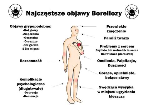 Objawy Boreliozy Vita Medica