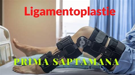 Recuperare Dupa Operatie Ligament Incrucisat Anterior PRIMA SAPTAMANA