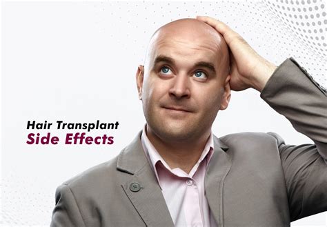 Managing Hair Transplant Side Effects Expert Insights And Tips