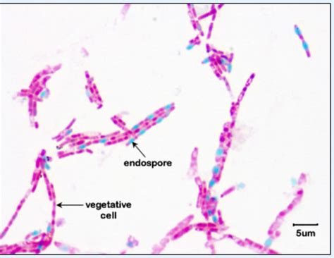 Microbiology Lab 7 Endoscopes And Bacterial Mobility Flashcards Quizlet