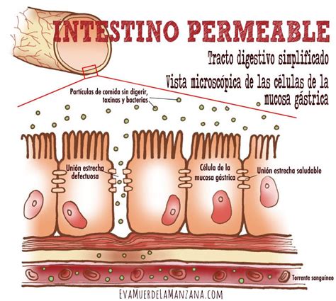 S Ntomas Que Indican Que Puedes Tener Sensibilidad Al Gluten