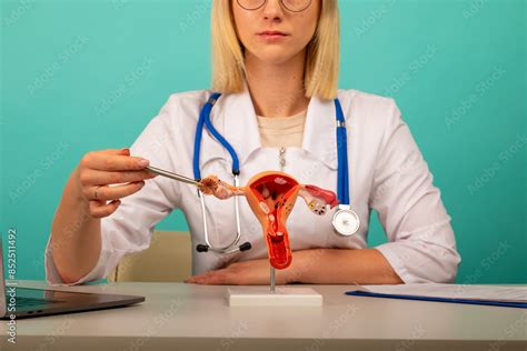 Doctor Gynecologist Showing Pen On Anatomical Model Of Uterus And