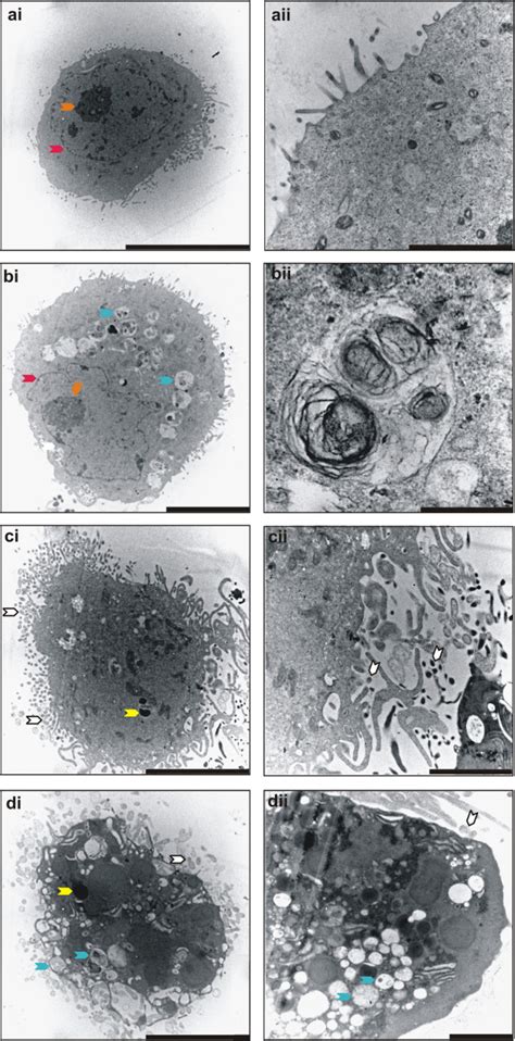 Transmission Electron Microscopy Of Exposed Hela Cells Ai Hela Cell