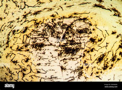 Brain Tissue Under The Microscope 100x Stock Photo Alamy