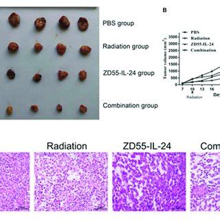 The Apoptosis Of PC 3 And DU 145 Cells Exposed To ZD55 IL 24 Or And