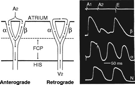 Current Textbook Model Of Dual Pathway Av Nodal Electrophysiology Left Download Scientific