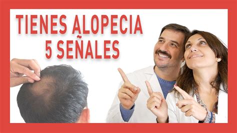 Cómo saber si te estás quedando calvo Signos de alopecia Clínica