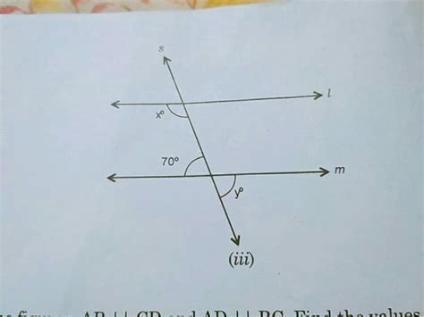 In The Figure Given Below L M And S Is Transversal Find X And Y