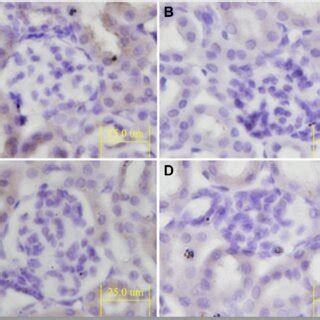 Representative Images Of Tumor Tissues After Anti CD31 Staining Bar 25