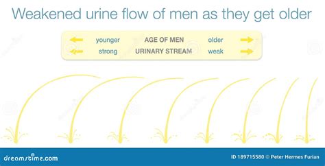 Weakened Urinary Flow Men Young Old Age Urine Stream Vector