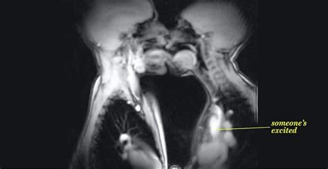 What Does Sex Look Like From The Inside Footage From An Mri Scanner Shows What Happens When We