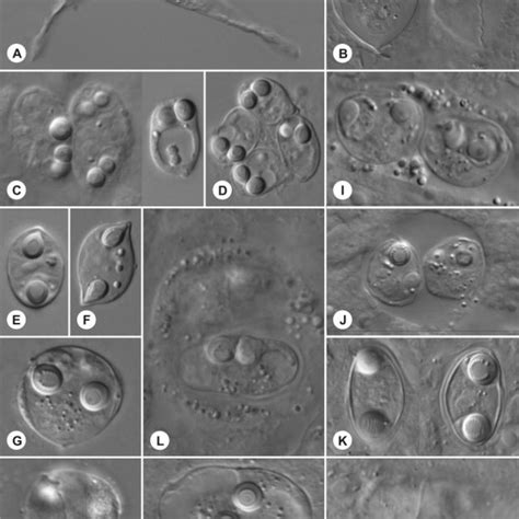 Mature Spores And Plasmodia A N Myxospores And Myxosporean