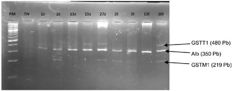 Profile Of Gstm And Gstt Genes By Multiplex Pcr Pm Molecular Weight