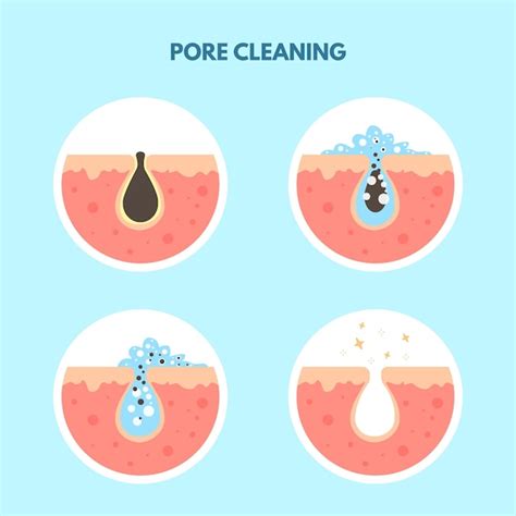 Premium Vector Removal Skin Blackheads Acne Oily Skin Cleansing