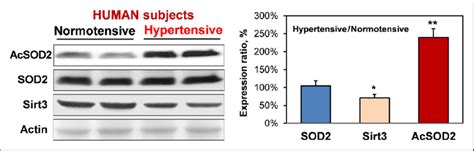 Representative Western Blot Analysis Of SOD2 Acetylation SOD2 And