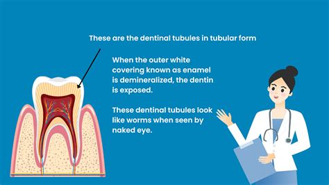 Do Rotten teeth have worms🪱 in it? - DG Dentist