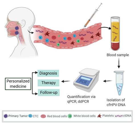 Cancers Free Full Text Cell Free Hpv Dna As A Biomarker For Oropharyngeal Squamous Cell