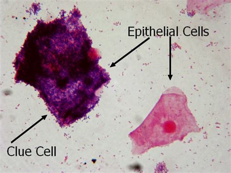 Clue Cell Microbiology Matters