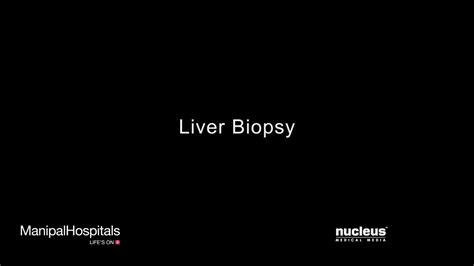 Liver Biopsy Youtube