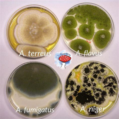 The most frequenty Aspegillus isolated in clinic samples #aspergillus # ...