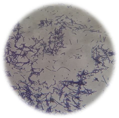 Microscopic observation of Gram's stained Lactobacillus spp. | Download ...