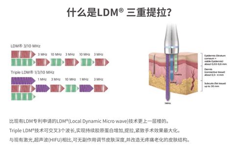 Ldm水滴提升到底是什么ldm水滴提升优势 知乎