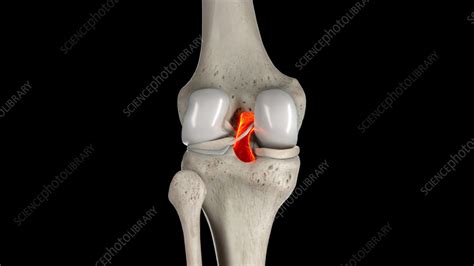 Posterior cruciate ligament, illustration - Stock Image - F038/0699 ...