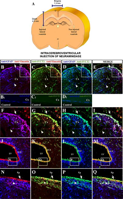 Svct2 Is Induced In Reactive Astrogliosis Generated By Download Scientific Diagram