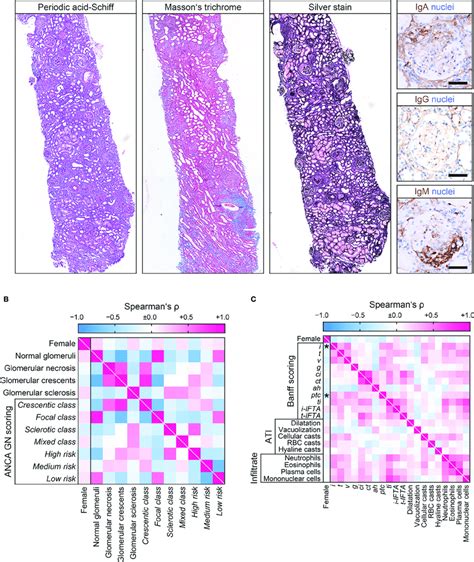 Sex Differences Among Histopathological Findings At Disease Download Scientific Diagram