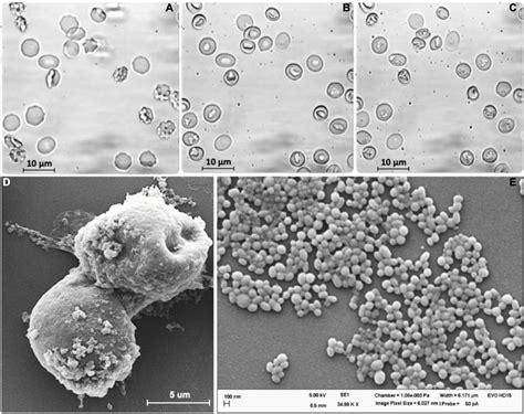 Frontiers The Relation Between Extracellular Vesicles Released From