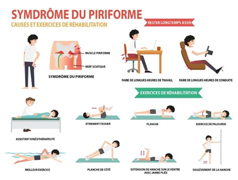 Combien De Temps Dure Le Syndrome Du Piriforme Information