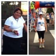 Gastric Sleeve Before and After Pictures | 2020 Success Stories of VSG