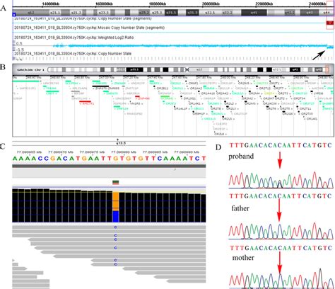 The Result Of Chromosomal Microarray Analysis And Whole Exome