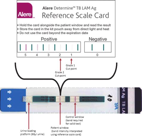 Urine Lipoarabinomannan LAM Strip Test And Reference Scale Card The