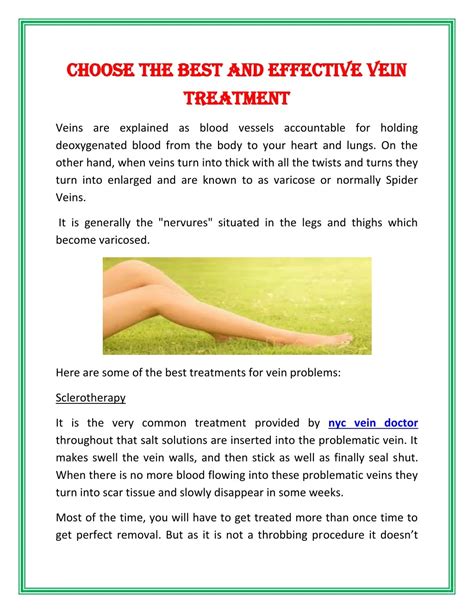 Ppt Choose The Best And Effective Vein Treatment Powerpoint