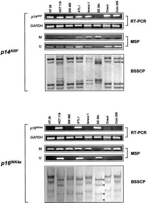 Analysis Of P14ARF And P16INK4a MRNA Expression And Gene Methylation In