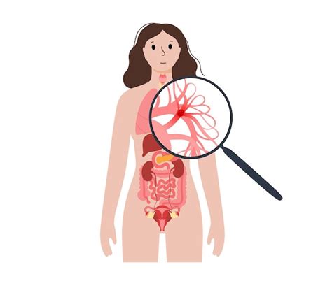 Doen A De Embolia Pulmonar Vetor Premium