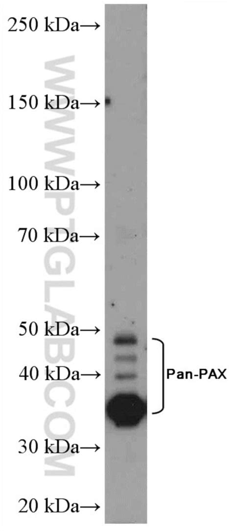 Pan PAX Rabbit anti Human Mouse Rat Polyclonal Proteintech 20 μL