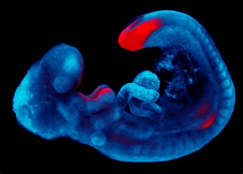 kenneth mcelreavey human developmental genetics research institut