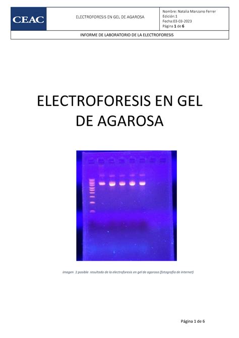 Informe De Electroforesis Lcb Edición Fecha 03 03 Página 1 De 6 Electroforesis En Gel De