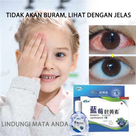 Tetes Mata Minus Obat Mata Minus Obat Tetes Mata Obat Mata Katarak 15ml