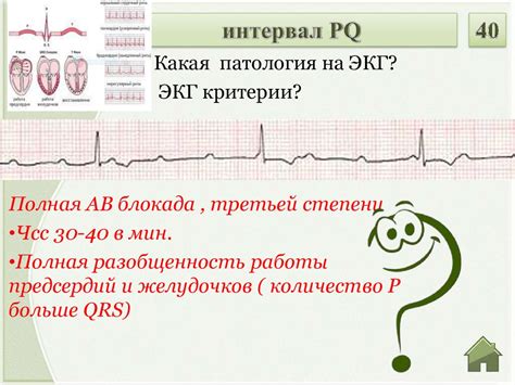 Интерактивная игра по ЭКГ - презентация онлайн