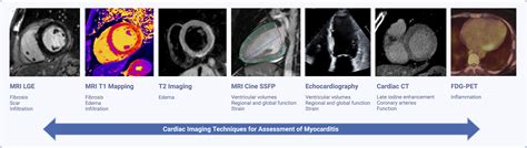 Cardiac Imaging In Myocarditis Current Evidence And Future Directions