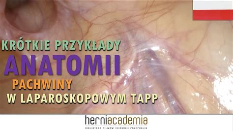 Przyk Ady Anatomii Okolicy Pachwiny W Laparoskopowych Operacjach