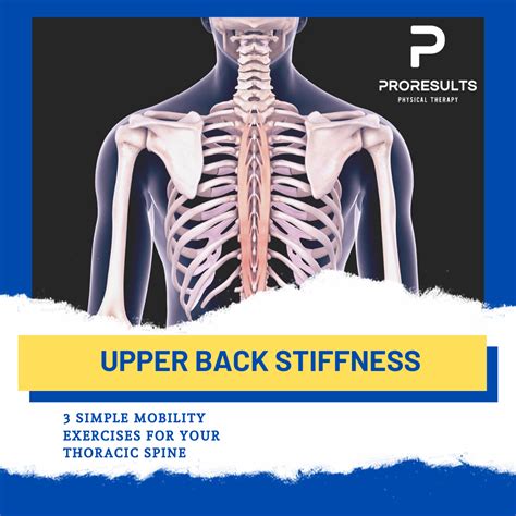 3 Simple Exercises to Ease Upper Back Stiffness - ProResults Physical Therapy